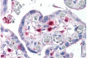 Human Placenta: Formalin-Fixed, Paraffin-Embedded (FFPE) (Pleckstrin antibody  (AA 121-231))
