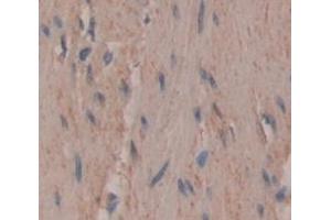 Used in DAB staining on fromalin fixed paraffin- embedded skeletal muscle tissue (UNG antibody  (AA 1-313))