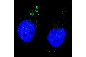 Fluorescent image of Chloroquine treated U251 cells stained with phospho-ULK1 antibody at 1:200. (ULK1 antibody  (pSer556))