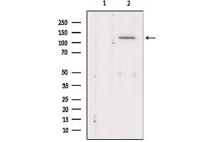 Western blot analysis of extracts from Mouse Myeloma cell, using MaxiK alpha Antibody.