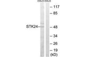 Western blot analysis of extracts from COLO cells, using STK24 Antibody. (STK24 antibody  (AA 319-368))