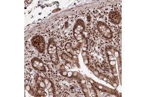 Immunohistochemical staining of human colon with KIAA1128 polyclonal antibody  shows strong nuclear and cytoplasmic positivity in glandular cells.