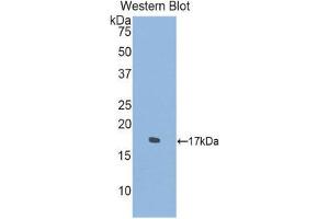 Western Blotting (WB) image for anti-Sema Domain, Immunoglobulin Domain (Ig), Transmembrane Domain (TM) and Short Cytoplasmic Domain, (Semaphorin) 4D (SEMA4D) (AA 502-636) antibody (ABIN1860524)