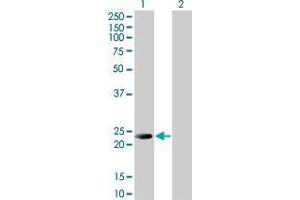 Lane 1: RAB39B transfected lysate ( 24. (RAB39B 293T Cell Transient Overexpression Lysate(Denatured))