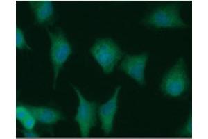 ICC/IF analysis of NUDT1 in A549 cells line, stained with DAPI (Blue) for nucleus staining and monoclonal anti-human NUDT1 antibody (1:100) with goat anti-mouse IgG-Alexa fluor 488 conjugate (Green). (NUDT1 antibody)