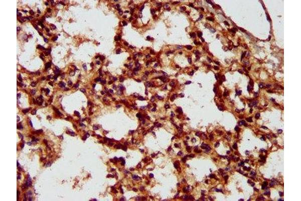 LMCD1 antibody  (AA 105-268)