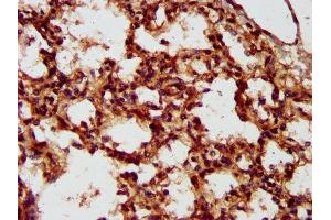 IHC image of ABIN7158336 diluted at 1:300 and staining in paraffin-embedded human lung tissue performed on a Leica BondTM system. (LMCD1 antibody  (AA 105-268))