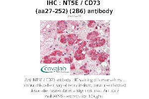 Image no. 1 for anti-5'-Nucleotidase, Ecto (CD73) (NT5E) (AA 27-252) antibody (ABIN1723204) (CD73 antibody  (AA 27-252))