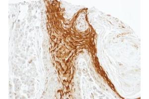 IHC-P Image Immunohistochemical analysis of paraffin-embedded SG xenograft, using RAMP2, antibody at 1:100 dilution. (RAMP2 antibody  (C-Term))