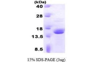 SDS-PAGE (SDS) image for FK506 Binding Protein 2, 13kDa (FKBP2) (AA 22-142) protein (ABIN667129)