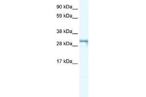 Human Jurkat; WB Suggested Anti-SHOX2 Antibody Titration: 0. (SHOX2 antibody  (Middle Region))
