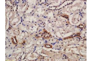 Formalin-fixed and paraffin embedded rat kidney labeled with Anti-KIBRA Polyclonal Antibody, Unconjugated  at 1:200 followed by conjugation to the secondary antibody and DAB staining