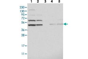 Western blot analysis of Lane 1: RT-4, Lane 2: U-251 MG, Lane 3: Human Plasma, Lane 4: Liver, Lane 5: Tonsil with ADSS polyclonal antibody  at 1:250-1:500 dilution. (ADSS antibody)