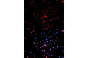 Immunofluorescence analysis of U2OS cells using Phospho-Jun-S73 antibody (ABIN5969904). (C-JUN antibody  (pSer73, Ser73))