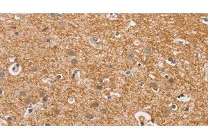 Immunohistochemistry of paraffin-embedded Human brain using CYP4A11 Polyclonal Antibody at dilution of 1:30 (CYP4A11 antibody)