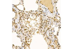 Immunohistochemistry (IHC) image for anti-Cbl-Interacting Protein Sts-1 (STS1) (AA 1-300) antibody (ABIN6149775)