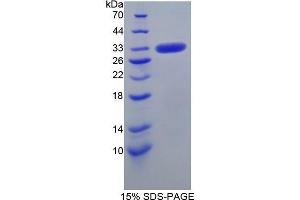 SDS-PAGE (SDS) image for Carbonic Anhydrase VB, Mitochondrial (CA5B) (AA 34-317) protein (His tag) (ABIN1079047)