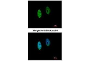 ICC/IF Image Immunofluorescence analysis of paraformaldehyde-fixed HeLa, using DENND1B, antibody at 1:200 dilution. (DENND1B antibody  (Center))