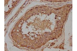 IHC image of ABIN7143324 diluted at 1:100 and staining in paraffin-embedded human testis tissue performed on a Leica BondTM system.