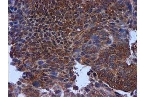 Image no. 4 for anti-Metalloproteinase Inhibitor 2 (TIMP2) antibody (ABIN1501393)