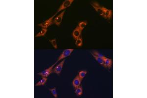 Immunofluorescence analysis of NIH-3T3 cells using  Rabbit mAb (ABIN1681069, ABIN3018897, ABIN3018898 and ABIN7101684) at dilution of 1:100 (40x lens).