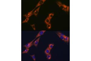 Immunofluorescence analysis of NIH-3T3 cells using  Rabbit mAb (ABIN1681069, ABIN3018897, ABIN3018898 and ABIN7101684) at dilution of 1:100 (40x lens). (alpha Adaptin antibody)