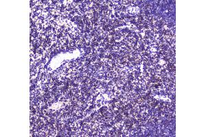 Immunohistochemistry (IHC) image for anti-Core-Binding Factor, beta Subunit (CBFB) (AA 1-182) antibody (ABIN5693076)