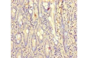Immunohistochemistry of paraffin-embedded human small intestine tissue using ABIN7164149 at dilution of 1:100 (PCF11 antibody  (AA 409-604))