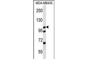 CTNND2 Antibody (C-term) (ABIN656479 and ABIN2845759) western blot analysis in MDA-M cell line lysates (35 μg/lane). (CTNND2 antibody  (C-Term))