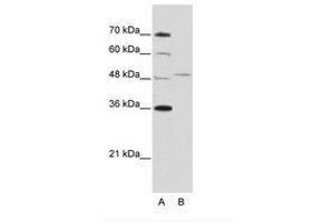 Image no. 2 for anti-Forkhead Box Q1 (FOXQ1) (AA 29-78) antibody (ABIN202435) (FOXQ1 antibody  (AA 29-78))