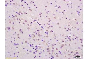 Immunohistochemistry (IHC) image for anti-SHC (Src Homology 2 Domain Containing) Transforming Protein 1 (SHC1) (pTyr349), (pTyr350) antibody (ABIN745973)