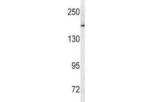 Western blot analysis of MRP1 antibody and human Ramos lysate. (ABCC1 antibody  (AA 1247-1275))
