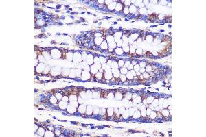Immunohistochemistry of paraffin-embedded Human colon using NEK9 antibody (ABIN7268914) at dilution of 1:100 (40x lens). (NEK9 antibody  (AA 730-979))