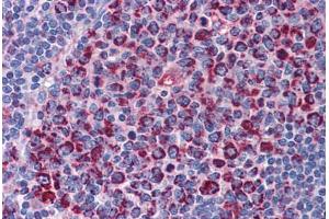 Human Tonsil: Formalin-Fixed, Paraffin-Embedded (FFPE) (SH3BP5 antibody  (AA 4-113))