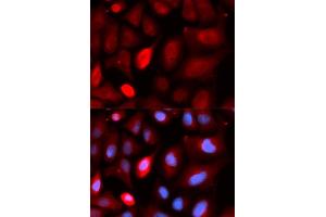 Immunofluorescence analysis of U2OS cells using PDLIM5 antibody (ABIN5973350). (PDLIM5 antibody)