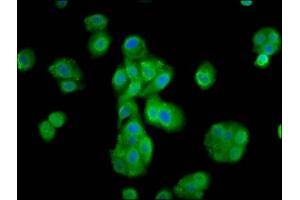 Immunofluorescence staining of HepG2 cells with ABIN7168291 at 1:133, counter-stained with DAPI.