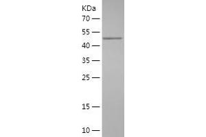 Western Blotting (WB) image for Zinc Finger E-Box Binding Homeobox 2 (ZEB2) (AA 1012-1214) protein (His-IF2DI Tag) (ABIN7125773) (ZEB2 Protein (AA 1012-1214) (His-IF2DI Tag))