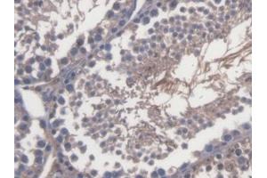 DAB staining on IHC-P; Samples: Mouse Testis Tissue (TRERF1 antibody  (AA 785-942))