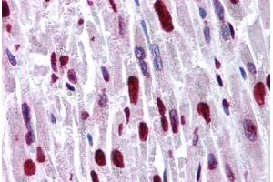 Human Heart (formalin-fixed, paraffin-embedded) stained with HIPK2 antibody ABIN214774 at 5 ug/ml followed by biotinylated goat anti-rabbit IgG secondary antibody ABIN481713, alkaline phosphatase-streptavidin and chromogen. (HIPK2 antibody  (AA 384-433))