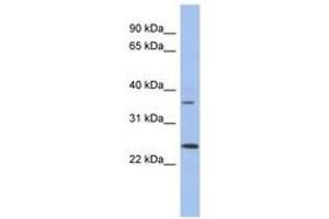 Image no. 1 for anti-WBP2 N-terminal Like (WBP2NL) (N-Term) antibody (ABIN6743704) (WBP2NL antibody  (N-Term))