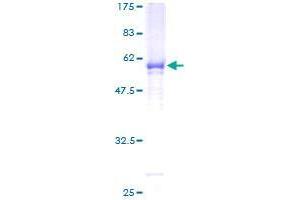 GALNT12 Protein (AA 1-272) (GST tag)