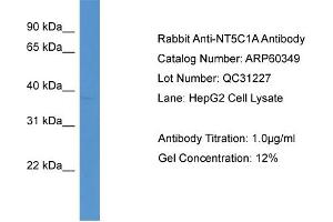 WB Suggested Anti-NT5C1A  Antibody Titration: 0. (NT5C1A antibody  (C-Term))