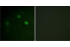 Immunofluorescence analysis of COS7 cells, using CDK1/CDC2 (Phospho-Thr14) Antibody.
