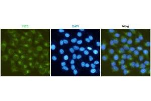 Iunofluorescent analysis of Hela cells fixed fixed by anhydrous methanol at -20 °C and using P-2 mouse mAb (dilution 1:50). (MMP2 antibody)