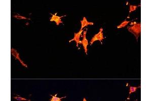 Immunofluorescence analysis of C6 cells using MST1 Polyclonal Antibody at dilution of 1:100. (MST1 antibody)