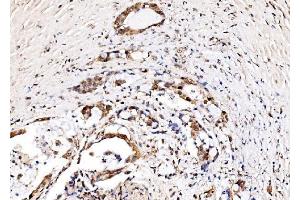 IHC analysis of IFI16 using anti-IFI16 antibody (ABIN7600374). (IFI16 antibody  (AA 183-743))