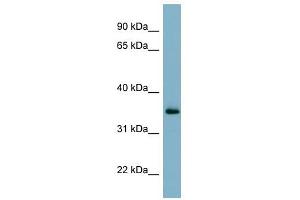 GEM antibody used at 1 ug/ml to detect target protein. (GEM antibody  (N-Term))