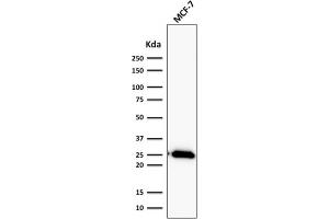 ABIN6383843 to BCL2 was successfully used to stain an approx. (Recombinant Bcl-2 antibody)