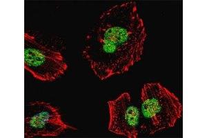 Fluorescent confocal image of HeLa cell stained with Nucleolin antibody at 1:25. (Nucleolin antibody)