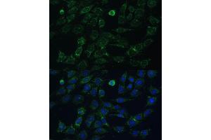 Immunofluorescence analysis of C6 cells using GK2 antibody (ABIN7267458) at dilution of 1:100. (GK2 antibody  (AA 1-150))